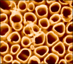 Scanning electron microscope image